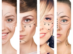 Women with Lines on Faces Showing Plastic Surgery Plans