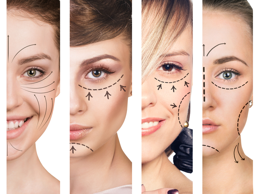 Women with Lines on Faces Showing Plastic Surgery Plans