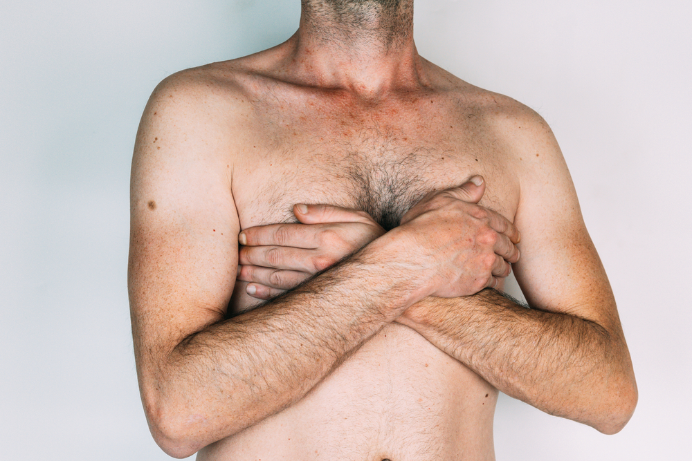 What Is Gynecomastia and How Does It Affect You?