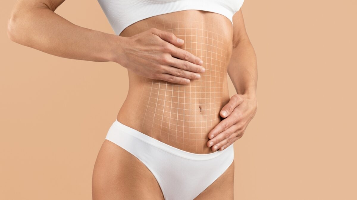 3 Things All Moms Should Know When Considering a Tummy Tuck - UCI Plastic  Surgery