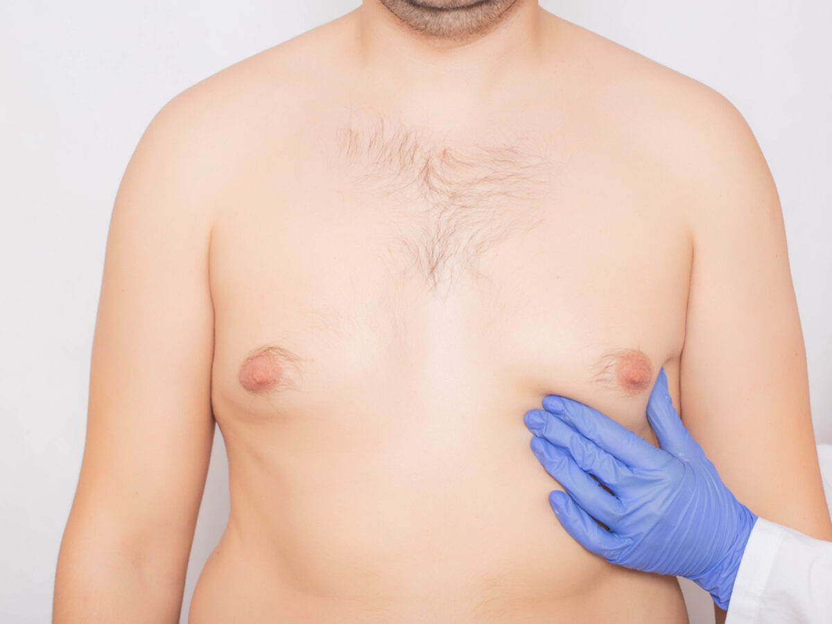 Get Fit for Summer With Gynecomastia Surgery Iconic Plastic Surgery